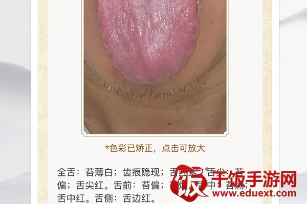 ����ͷ(���｡������)