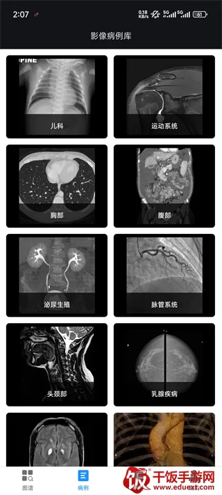 影像解剖图谱(医学影像学习平台) 影像解剖图谱(医学影像学习平台)