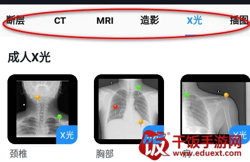 影像解剖图谱(医学影像学习平台) 影像解剖图谱(医学影像学习平台)