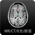 Ӱ�����ͼ��(ҽѧӰ��ѧϰƽ̨)v4.6.5 ��Ѱ�